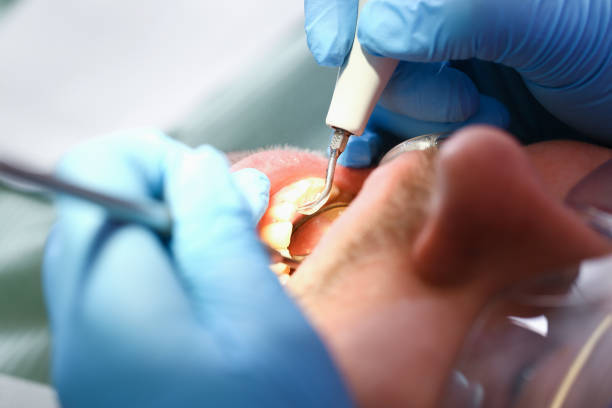 Best Emergency TMJ Treatment in Walnut Creek, OH