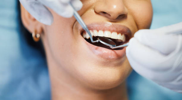 Best Same-Day Emergency Dental Services in Walnut Creek, OH